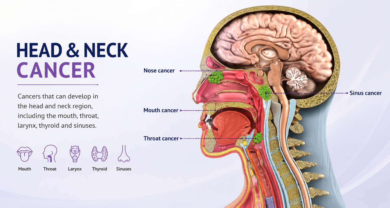 Head & Neck Cancer